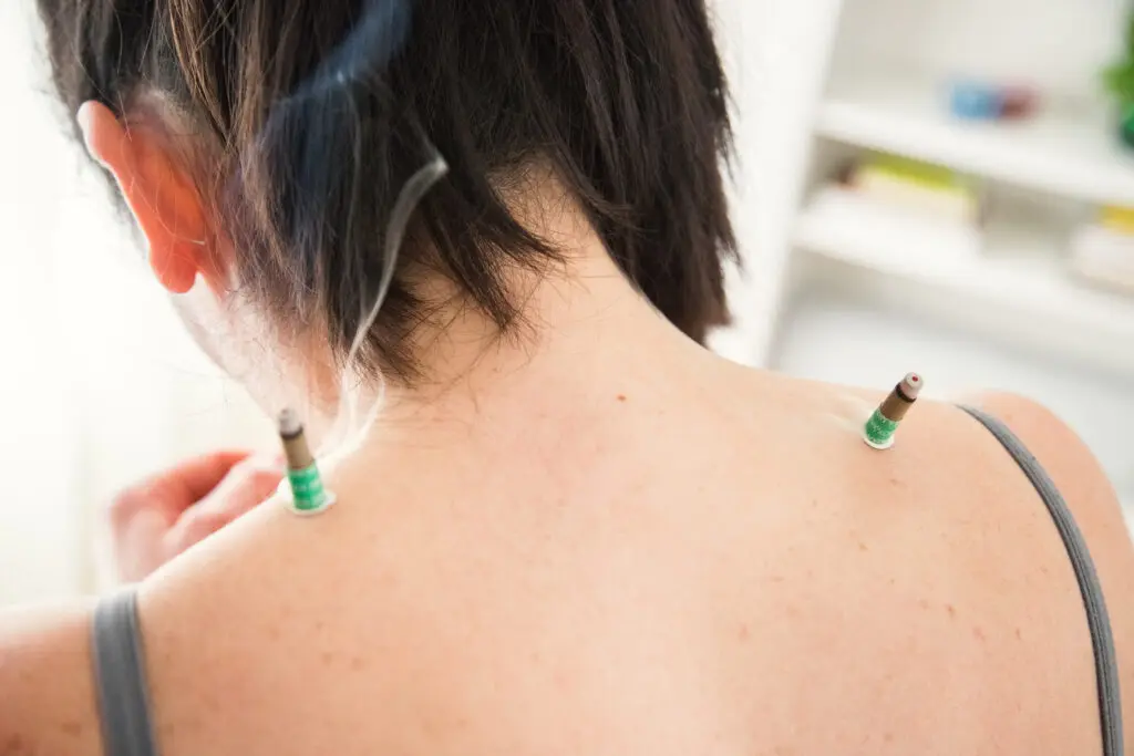 Person receiving acupuncture treatment with needles on their neck.